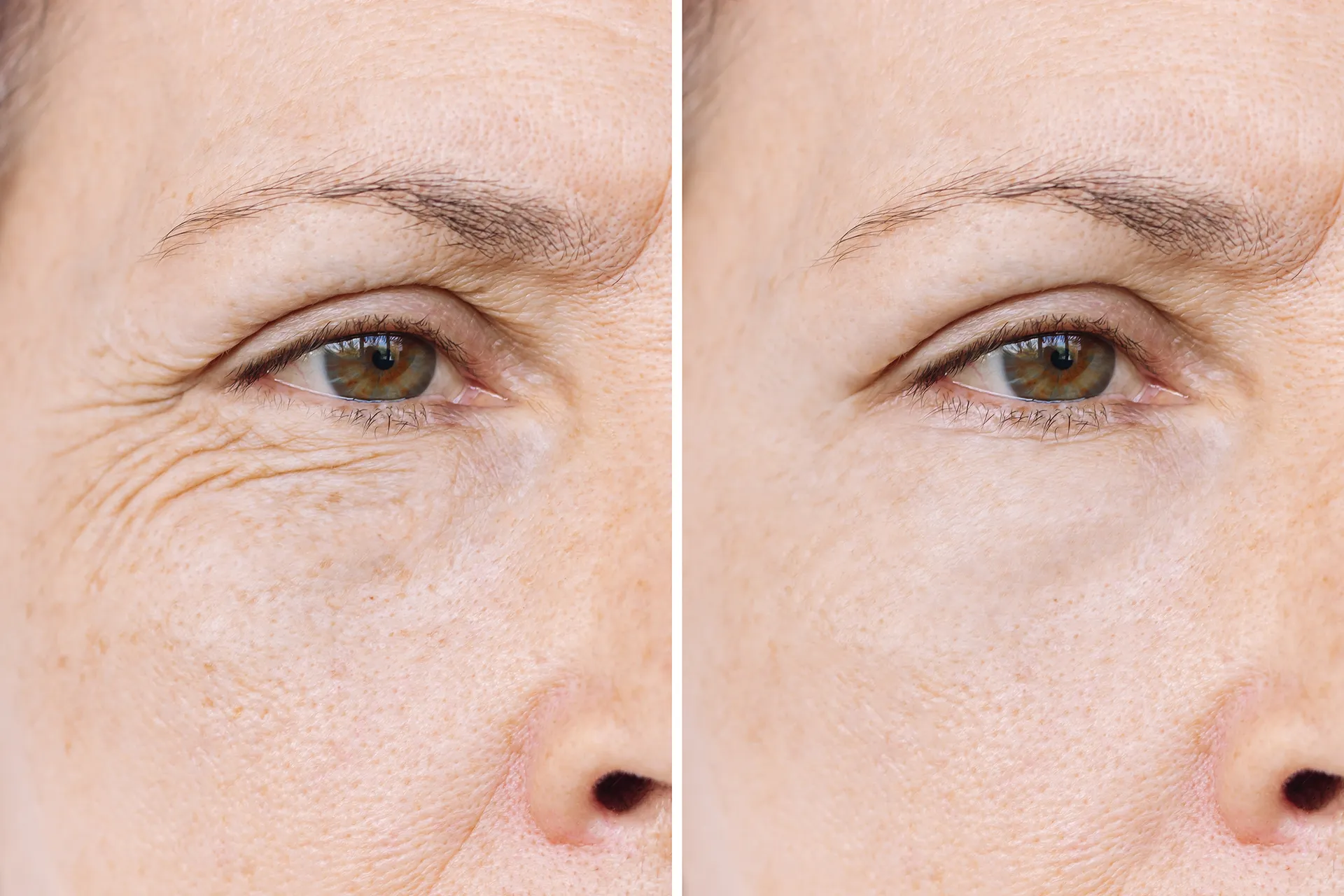 A close-up of an aging woman's eye area, showing wrinkles on the left side and smoother skin on the right side, indicating a before-and-after effect.