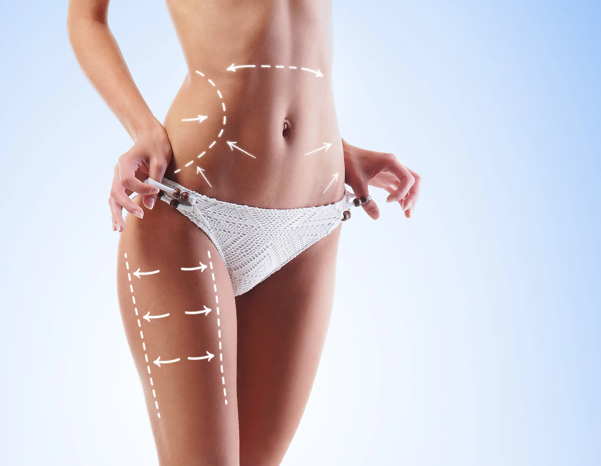 A close-up view of a woman’s abdomen and thigh area, with dotted lines and arrows indicating body contouring.  