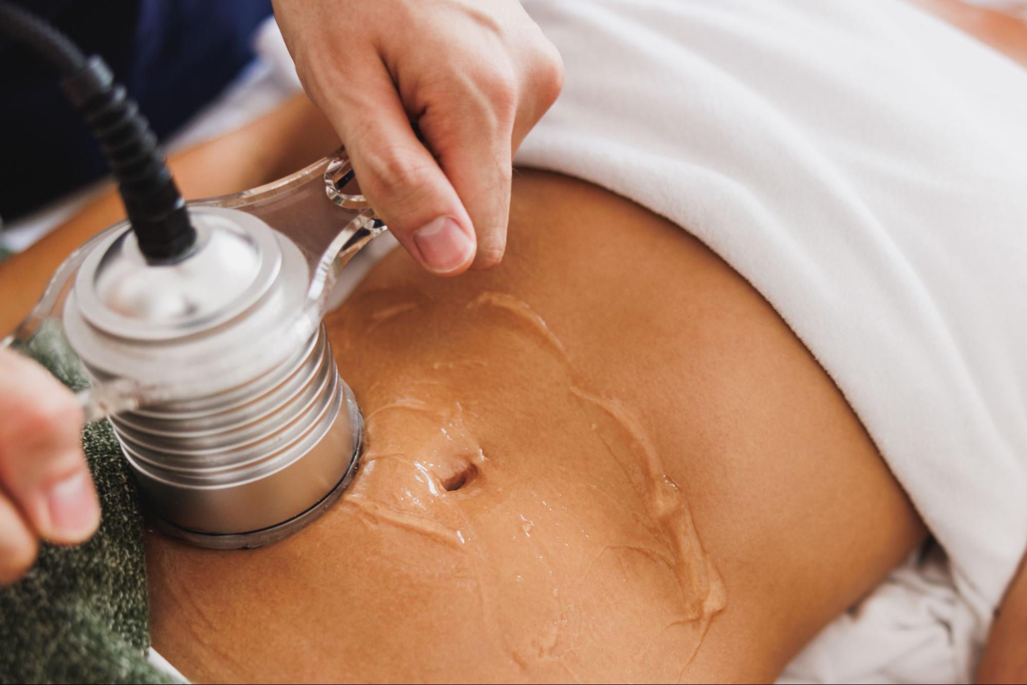 What is Body Sculpting?